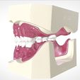 15.jpg Digital Full Dentures for Gluedin Teeth with Manual Reduction