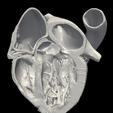 1.png 3D Model of Heart (apical 5 chamber plane)