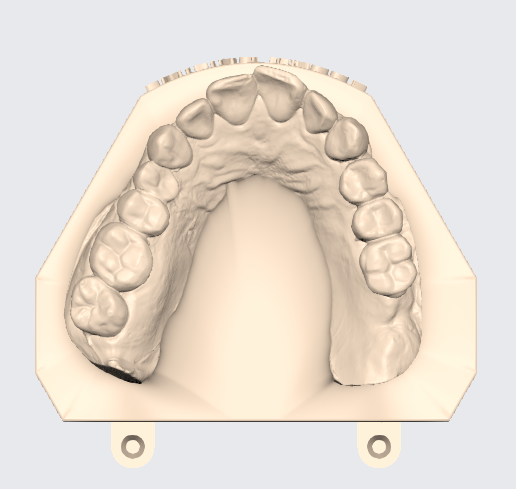 🦷 ARTICULATED UPPER AND LOWER DENTAL MODEL (7)・Free STL File for 3D ...