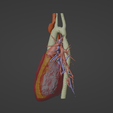 3.png 3D Model of Human Heart with Co-Arctation (CA) - generated from real patient