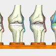 1.jpg total knee replacement model ( TKR ), EDUCATING / TEACHING MODEL
