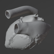 15.png 3D Model of Heart (apical 5 chamber plane)