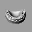 Modelo-1.jpg Practice of dental cavities