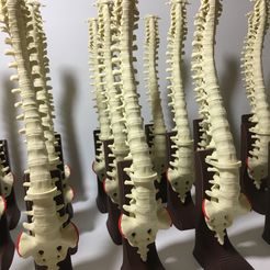 IMG_5217.jpg SPINE WITHOUT SUPPORTS PROFESSIONAL MEDICINE
