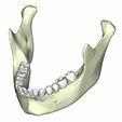 14.jpg mandible with teeth