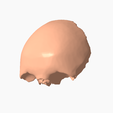 2.png FRONTAL BONE SEGMENTED 3D MODEL