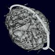 screenshot165.jpg Central nervous system cortex limbic basal ganglia stem cerebel 3D model