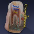image-0030.jpg Corte esquemático de los dientes etiquetado
