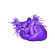 STL.stl 3D Model of Human Heart with Hypertrophic Cardiomyopathy - generated from real patient