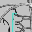 wfsub-0015.jpg Human venous system schematic 3D