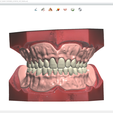 Screenshot_5.png Digital Try-in Full Dentures for Injection Molding