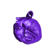 tof.stl 3D Model of the Heart with Tetralogy of Fallot, parasternal long axis