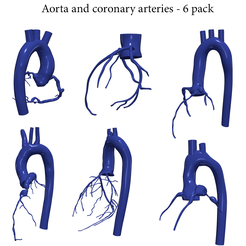 6-pack.png Modèle 3D de l'aorte et des artères coronaires - 6pack