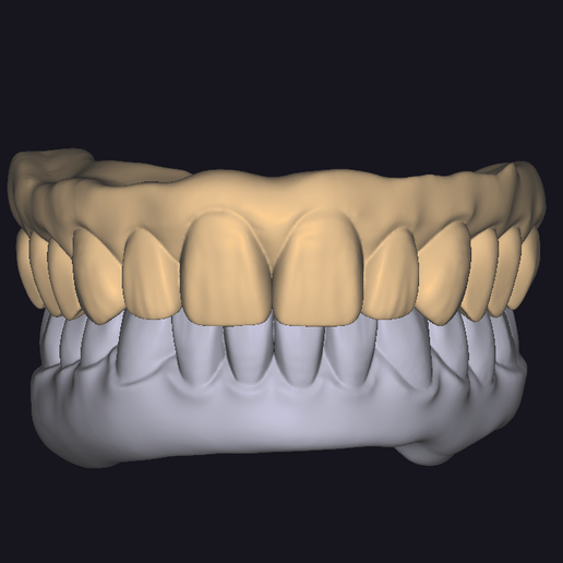 🦷 Upper arch dental design・ STL File for 3D printing・Cults