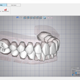 W311 Hole - Impression 1 ( oO Fle Treatment Planning (2 aia AAG Exporting <I? & A Export all Setups Hole Fix Label Delete Label > @ = Upper Jaw >» @ = Lower Jaw Web Viewer 2 Ga Export Documnets - og xX ~ 8x oe Bx. Setup 11 FL MD Ve ROT RQ TO] z 4L(R)CenIncisor 0.00 -0.20 0.00 8,00 0.00 -4.00 z 42(R) Lat incisor -0.40 -030 0.00 1200 -6.00 0.00 43(R)Canine 0.40 -0.40 0.00 20.00 0.00 0.00 44(R)F.Premolar -1.30 -0.70 0.00 30.00 0.00 0.00 45(R)S.Premolar -0.70 -0.40 0.00 30.00 0.00 0.00 46(R)F.Molar 0.00 0.00 0.00 0.00 0.00 0.00 31(L)CenIncisor 0.00 0.00 0.00 12.00 0.00 4.00 32(L) Lat incisor -0.40 0.20 0.00 -200 0.00 4.00 33(L) Canine «0.00 0.20 0.00 -10.00 0.00 0.00 34(L)F.Premolar 0.00 0.00 0.00 -32.00 0.00 0.00 35(L)S.Premolar 0.00 0.10 0.00 -12.00 0.00 0.00 36(L)F.Molar 0.00 -0.40 0.00 0.00 0.00 0.00 Version 5.0.4 TRANSPARENT ALIGNERS Pac A. 21 dental models or setups of UPPER AND LOWER MAXILLARY "READY FOR 3D PRINTER" - AREA3D - PATIENT A. COMPLETE DENTURE