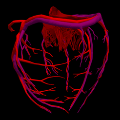 1.png Anatomie du cœur en 3D avec Codominance