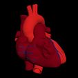 i1.jpg 3D Model of Heart with Atrial Septal Defect