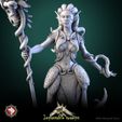 Klooh-Klooph-Muddy-Eyed_V4.jpg Archivo 3D Klooh-Klooph Muddy-Eyed 32mm y 75mm pre-soportado + dnd 5e stats block・Modelo de impresión 3D para descargar