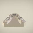 Snapshot_2017-3-1_13-13-14.jpg STL file Digital Dr.Williams's Ortho Appliance・3D print object to download