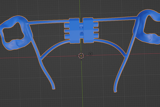 molar-distalizer,-teeth,-dental,-tooth,-palatal-expander,-appliance,-removable,-hilgers,-orthodontic.png High resolution Rapid Palatal Expander (Banded type) Dental appliance on Upper teeth