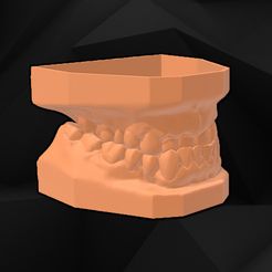 mod1.jpg Fichier STL Modèle dentaire・Design pour imprimante 3D à télécharger, Fil_3D