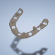metal-reinforcement-for-dental-prostheses2.png metal reinforcement for dental prostheses