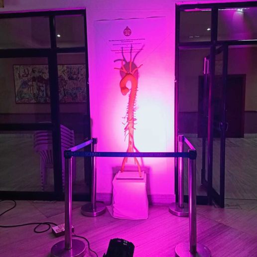 WhatsApp-Image-2024-09-27-at-17.54.55-1.jpeg Modelo 3D de aorta optimizado para impresión 3D