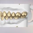 3.jpg 3D Dental Jaws Replica with Detachable Teeth