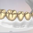 22.jpg 3D Dental Jaws Replica with Detachable Teeth