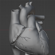 6.png 3D Heart Anatomy with Codominance