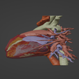 3.png 3D Model of Human Heart with Double Aortic Arch (DAA) - generated from real patient