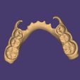 Clipboard-2024-06-11-20-41-25.jpg DIGITAL LOWER PARTIAL REMOVABLE DENTURE + 3D MODELS !