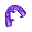 2025-02-24_00005-001-17-16-15-14-13-12-11-21-22-23-24-25-26-modelbase.stl exocad Dentallabor