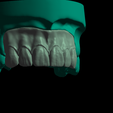 Screenshot_16.png Phantom dental model for dental technicians