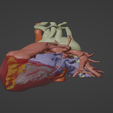 4.png 3D Model of Human Heart with Double Outlet Right Ventricle (DORV) - generated from real patient