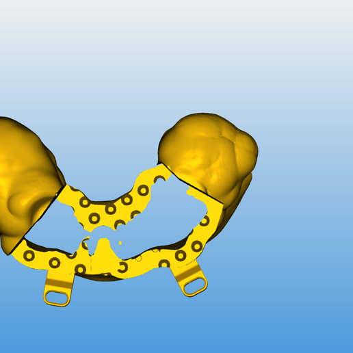 🎒 partial stackable guide・ STL File for 3D printing・Cults