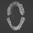 5.png Dental models with removable dies
