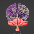 14.png 3D Model of Brain and Aneurysm