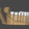 8.png Dental Model (in articulator)