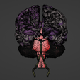 34.png 3D Model of Brain and Aneurysm