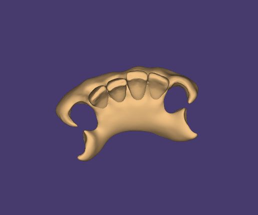 Clipboard-2024-12-21-00-51-07.jpg DIGITAL FLEXIBLE FLIPPER - LOWER BASE + 3D MODELS ! 5 stl files for download