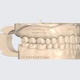 MeditLink_Image_Data.jpg MODELO PEDAGÓGICO DR CAPARACHINI STRAUMANN - NEODENT (INCLUINDO ANÁLOGOS)