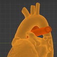 12.png 3D Model of Heart after Fontan Procedure