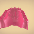 Screenshot_7.png Full Dentures with Many Production Options
