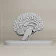 1.jpg Sección transversal del cerebro