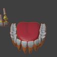 2.jpg 3D-Modell von Zahnimplantaten - Dentalmodell