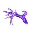 STL00007.stl Model of human heart with pulmonary atresia (PuA) - generated from real patient