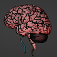 30.png 3D Model of Brain and Aneurysm