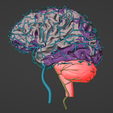 9.png 3D Model of Brain and Aneurysm