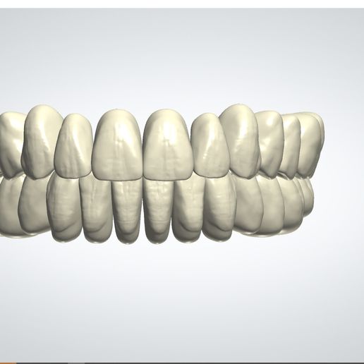 foto1.jpg 3Shape OPEN Library AP_Natural